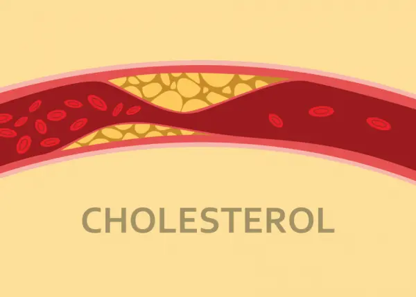 Cholesterol là gì?